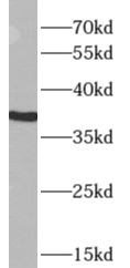      anti- APOL2 antibody