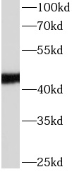 anti- APOL1 antibody