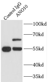 anti- ANO10 antibody