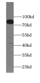 anti- ANO10 antibody