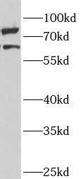      anti- ANKS3 antibody