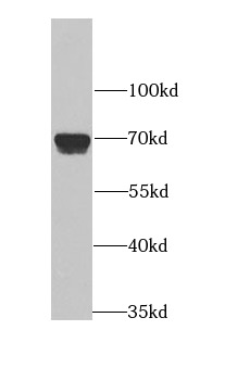 anti- APLP1 antibody