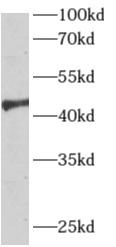 anti- APLNR antibody