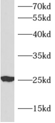 anti- APOM antibody