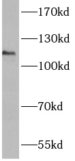      anti- ANO3 antibody