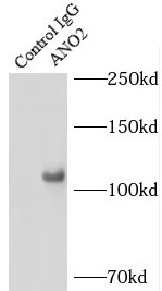      anti- ANO2 antibody