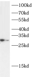      anti- APOD antibody