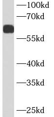      anti- alpha 1 Antichymotrypsin/AACT antibody