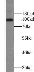      anti- APP antibody