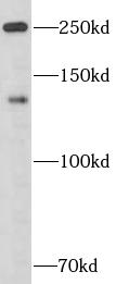      anti- APOB antibody