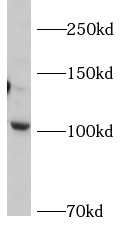      anti- AP2A2 antibody