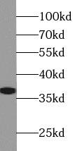      anti- APEX1 antibody