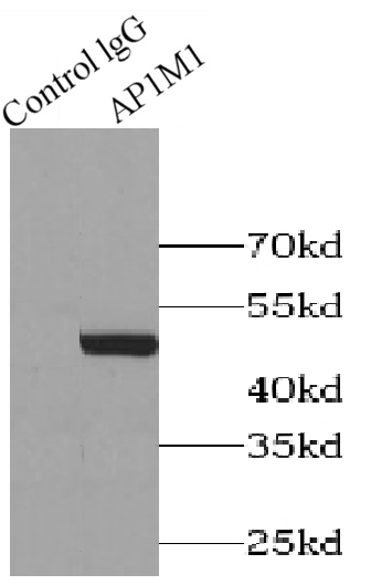 AP1M1抗体
