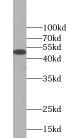 anti- AP1M1 antibody