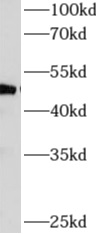      anti- AP4M1 antibody