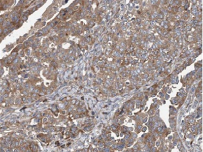 anti-AP3S2 antibody