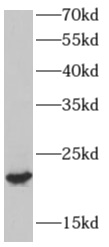 anti- AP3S2 antibody