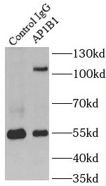 AP1B1抗体