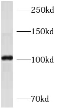      anti- AP1B1 antibody