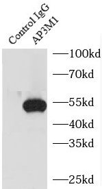 AP3M1抗体