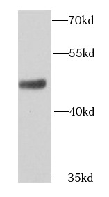      anti- AP1M2 antibody