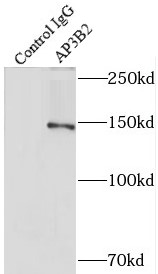 AP3B2抗体