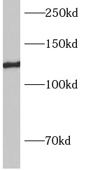      anti- AP3B2 antibody