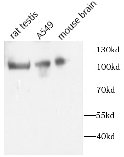 anti- AP2B1 antibody