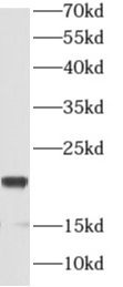      anti- APC11 antibody