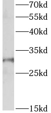      anti- APH1A antibody