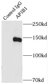 AP3B1抗体