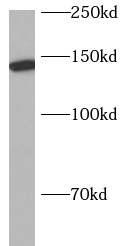      anti- AP3B1 antibody