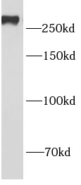      anti- APC antibody