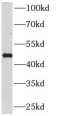 anti- AP3M2 antibody