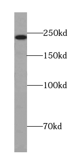 anti- APC1 antibody