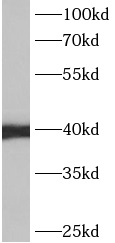      anti- Annexin A13 antibody