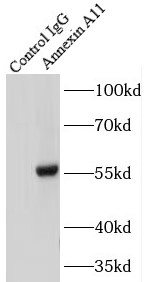 anti- Annexin A11 antibody