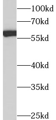 anti- Annexin A11 antibody