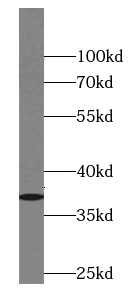 anti- Annexin VIII antibody