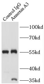      anti- Annexin A3 antibody