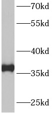      anti- Annexin A3 antibody