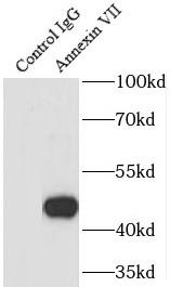      anti- Annexin VII antibody