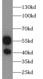      anti- Annexin VII antibody