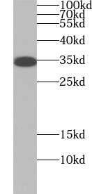      anti- Aquaporin 4 antibody