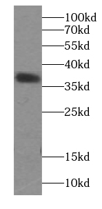 anti- ATX3,ATXN3 antibody