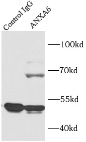      anti-Annexin VI antibody