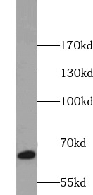      anti- Annexin VI antibody