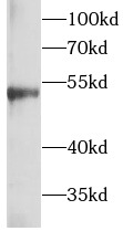 anti- Beta Tubulin antibody