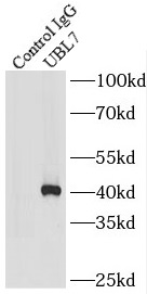      anti- BMSC UbP antibody