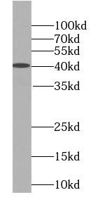      anti- BMSC UbP antibody